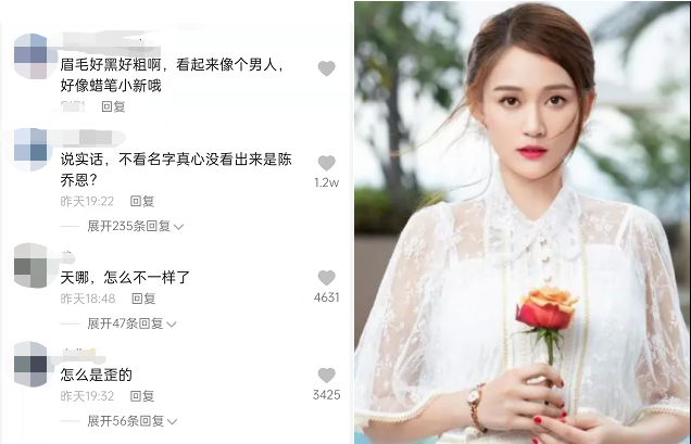 陈乔恩|陈乔恩病愈出院晒近照！鼻梁高挺眼睛超大，眉毛太浓太黑像个男人