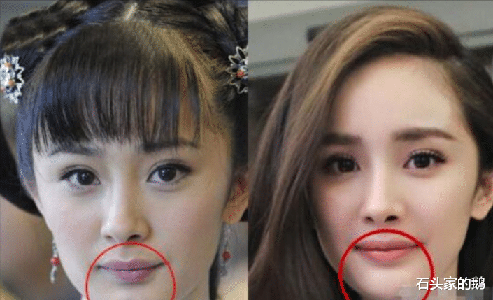 赵露思|盘点明星整容“翻车”现场，看她们是如何从“丑”变为“美！”！