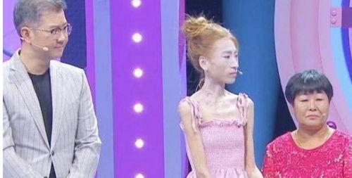 女孩|那个“骷髅女孩”刘野为男友减肥，从128斤瘦到58斤，她现状如何