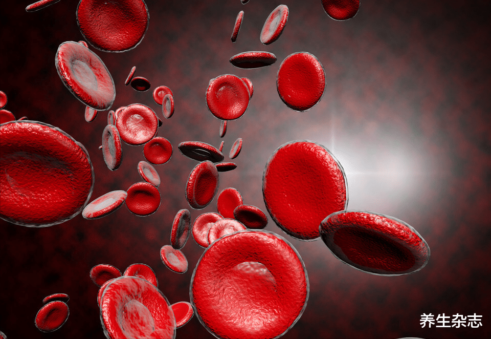 牛奶|血脂高的人,不能喝牛奶?医生道明:忌口2种食物,血管畅通无阻