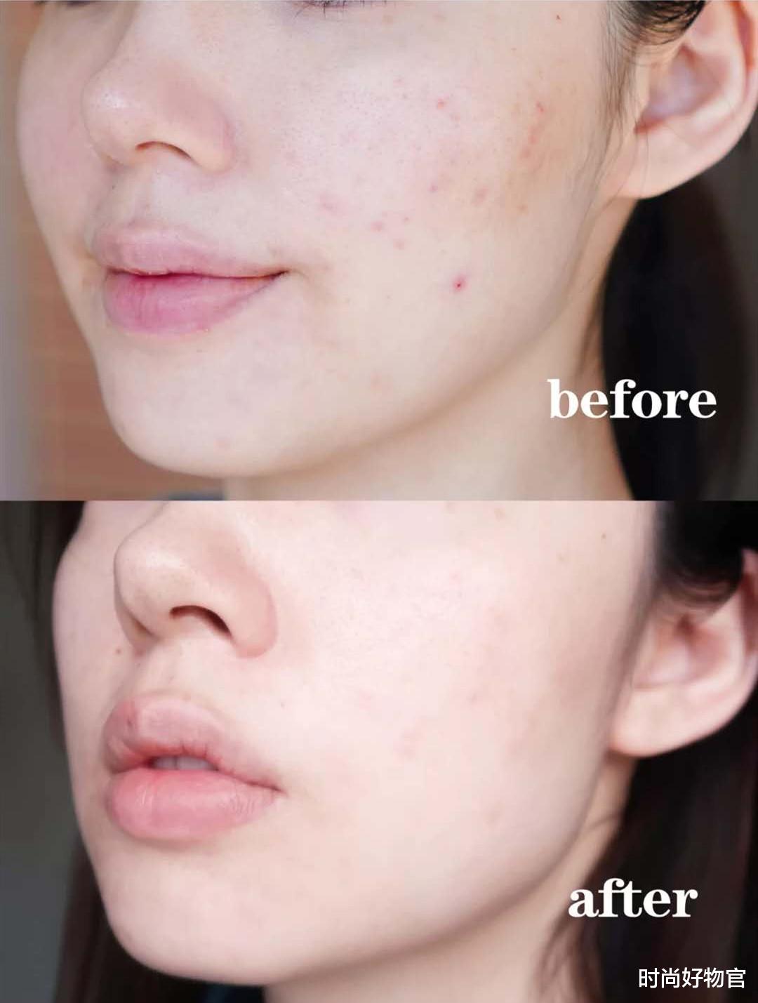 时尚好物官|“美容针”早失宠了！明星都爱美容仪，紧致嫩肤打造“婴儿肌”