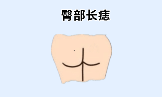 中国易经风水 身上5颗“福禄痣”，有吃有喝，啥也不愁，儿女双全，老了有钱又有福！