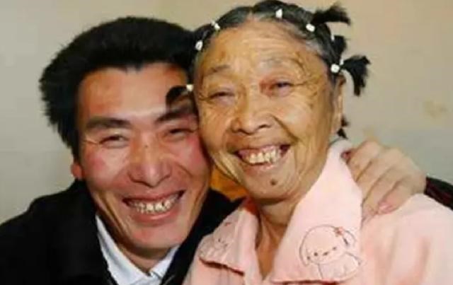李玉成|60岁老太整容成少女，只为与25岁男友终成眷属，如今过得怎样？