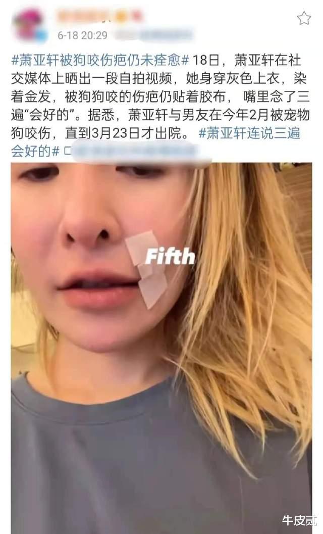 肖战|“恋爱大师”萧亚轩,才42岁就衰老成了这个样子,她到底经历了什么