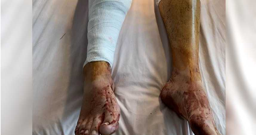 大国将苓 为赡养费吵不停！“亲家”变“仇家”，男子追砍前妻一家酿4伤