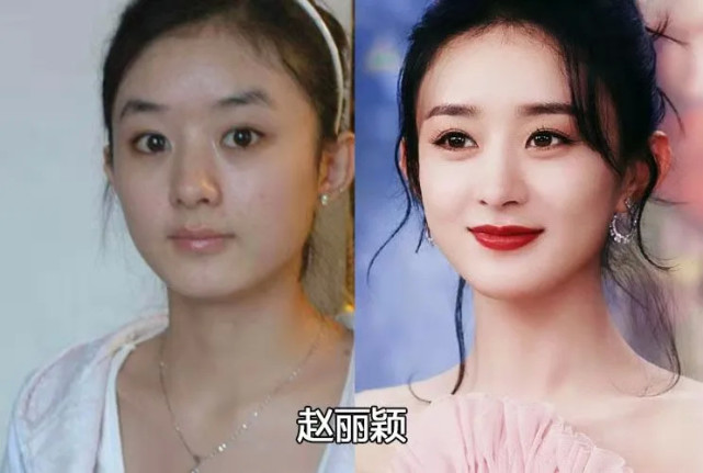 古力娜扎|赵丽颖、鞠婧祎、热巴、李沁、李小璐、古力娜扎出道前后对比