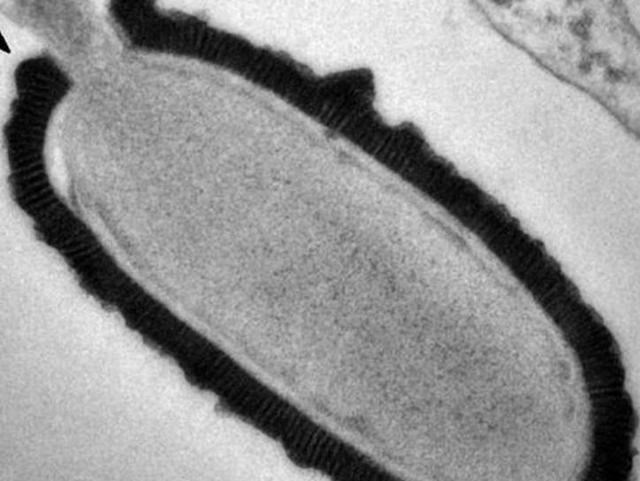 科学家 疯狂科学家为获永生,大胆注射350万年前猛犸象细菌,结果如何?