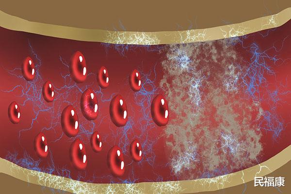 心血管疾病|老人常说“一勺猪油十副药”，真这么神奇？为何现在吃的人少了？