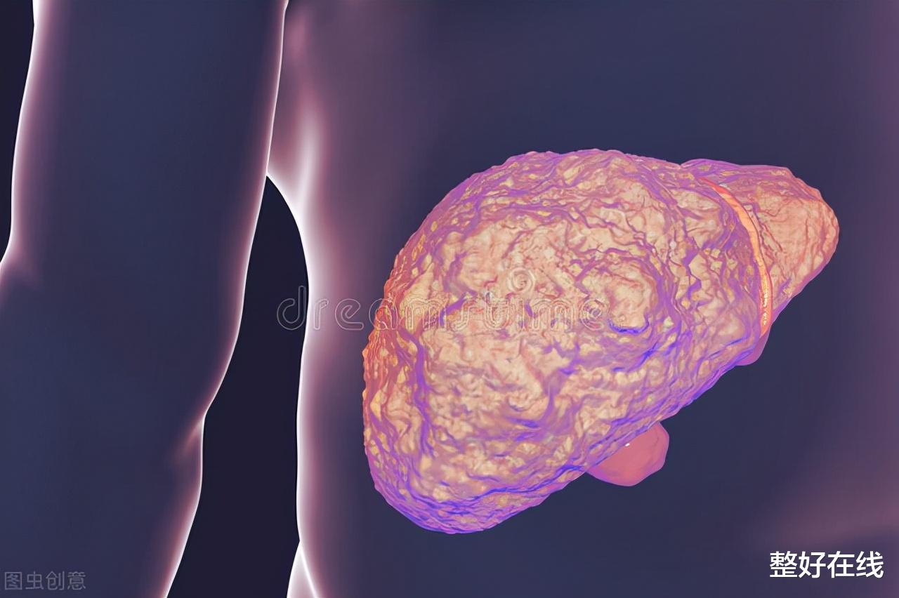 肝硬化|得了肝硬化怎么办?专家饮食上给你推荐“4招”,帮你缓解肝硬化