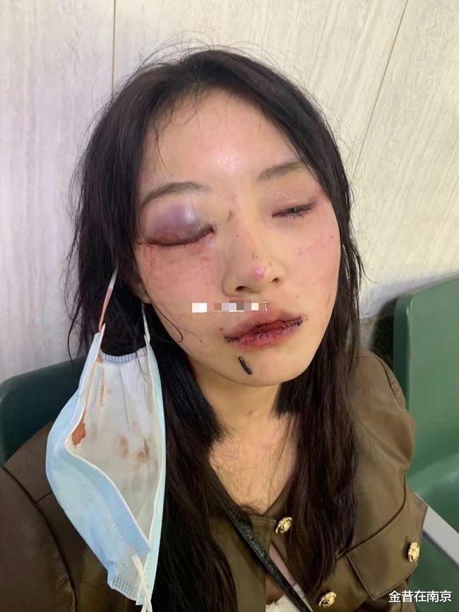 家暴 遭“家暴”如何处理？从200万粉丝网红“猪有蹄”曝光男友说起