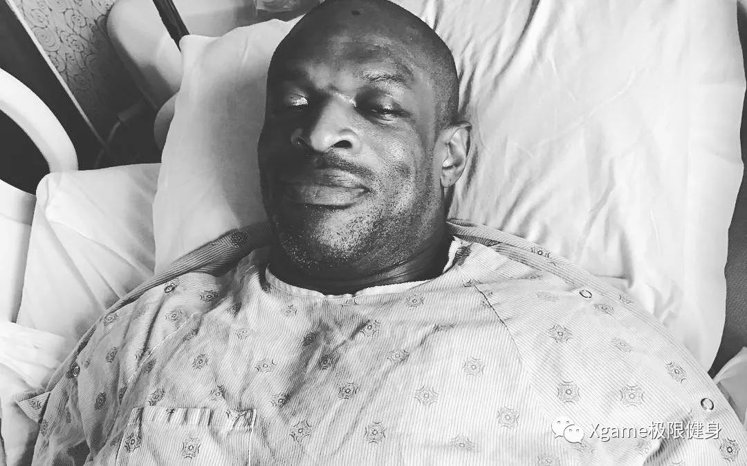 |健美之王现状:浑身疼痛、药不离身,每3小时吃一片止痛片