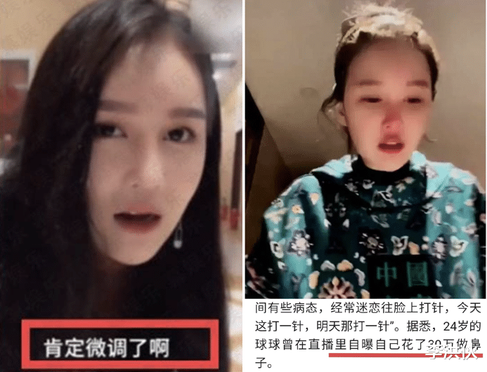 整容|赵本山老婆爆料女儿沉迷整容，不顾反对已成病态，鼻子就花了30万