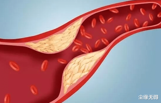 石榴|活血祛痰降血压