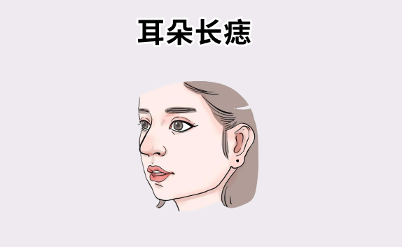 中国易经风水 “百里挑一的5颗痣”，颗颗带财，个个显贵，男人升官，女人生福！