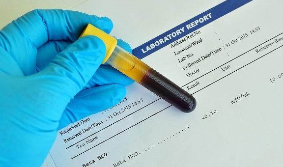 尹汪栎的小世界|孕期，若有这4种情况，可能是胎停的“前兆”，孕妈最好早知道