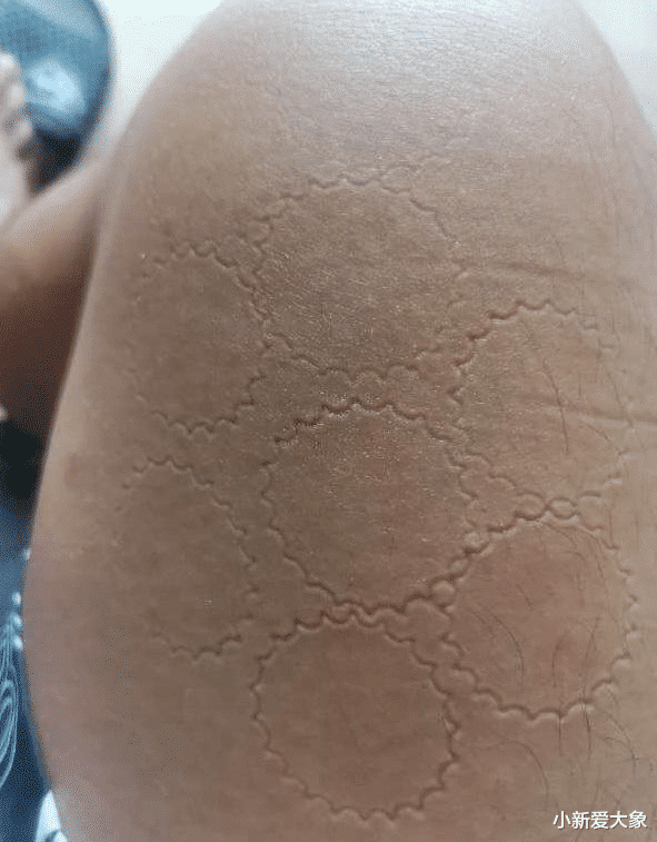 |“姑娘，你还是别穿白长裤了，拿手帕也挡不住了！”哇哈哈哈