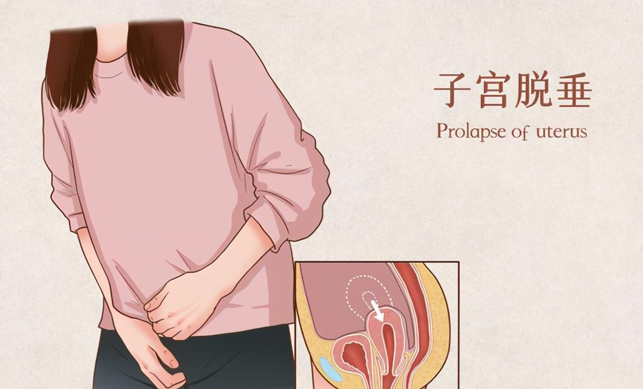 生理期|女性这4种行为伤子宫，年轻时别不当回事，替自己健康着想！