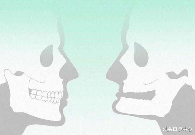汕头口腔中心|当我们失去牙齿，我们会变成什么样？你绝对没想到