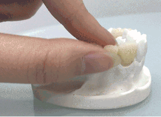 血栓|牙齿烂的只剩牙根，还能补救吗？