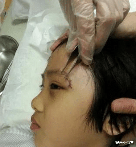 费曼|录制《爸爸》留下了永久性伤疤的费曼，已走出阴影，撩刘海露正脸