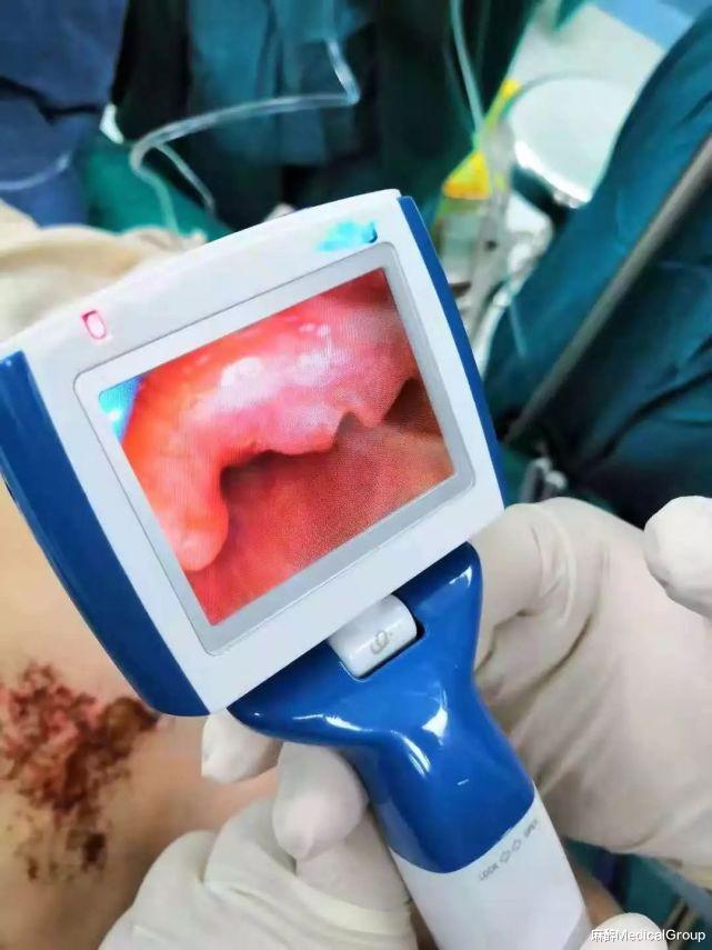 麻醉MedicalGroup|当糟牙和插管冲突时，如何选择？