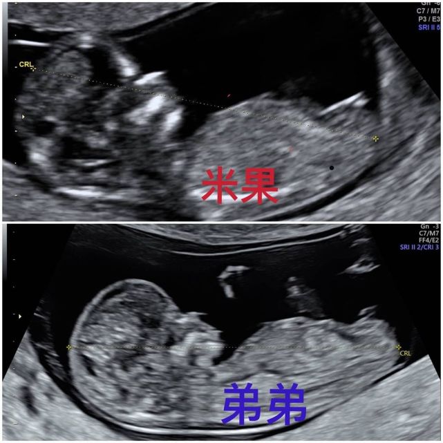 当家主母|罗志祥经纪人小霜宣布即将生产，儿女双全凑成好字，林心如送祝福