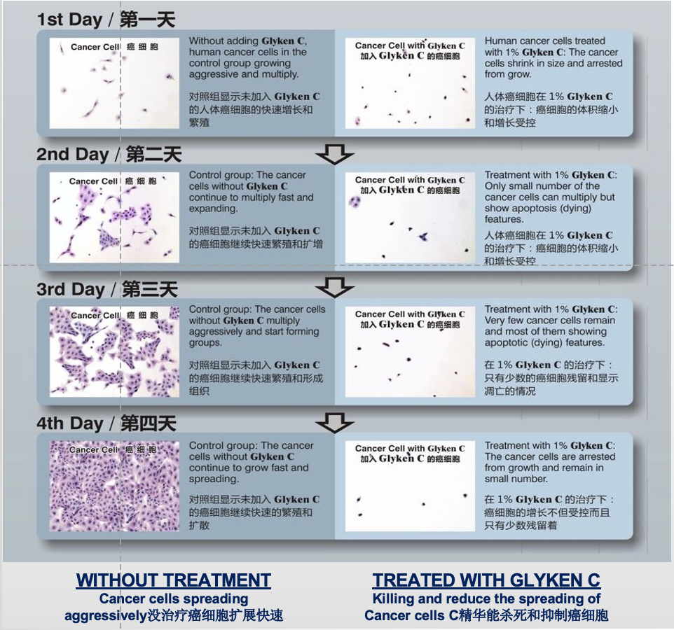 抗癌|我们盘点了各种「抗癌食物榜」,结果不吐不快……