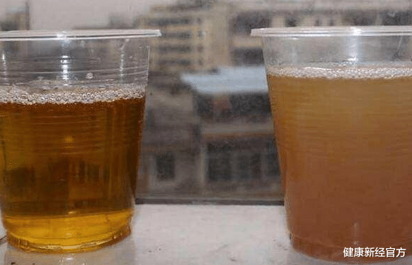 医生|23岁实习生确诊肾衰，透析后离世，医生：这“1物”吃一口等于10斤猪肉