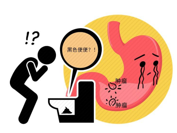 疾病|排便知长寿？医生提醒：排便时若有4个迹象，多半与长寿无缘！