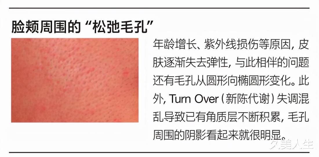 久美人生|朱茵扎双丸子头超减龄 修饰毛孔为颜值加分