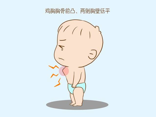 耳鼻喉申医生 孩子打鼾的那些事你知道多少？