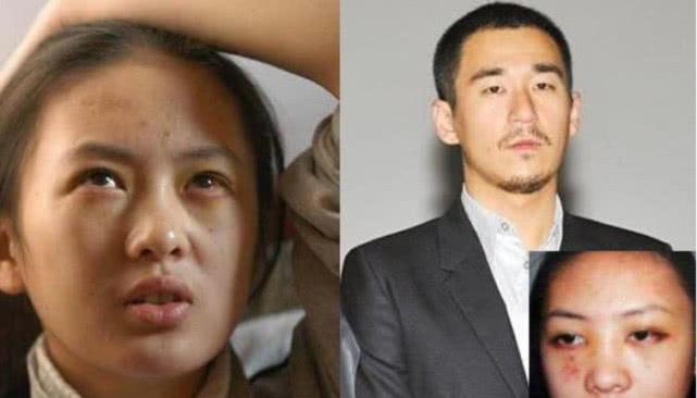 张默|张默谈童瑶：我打她是有原因的，换成你们会比我打的狠