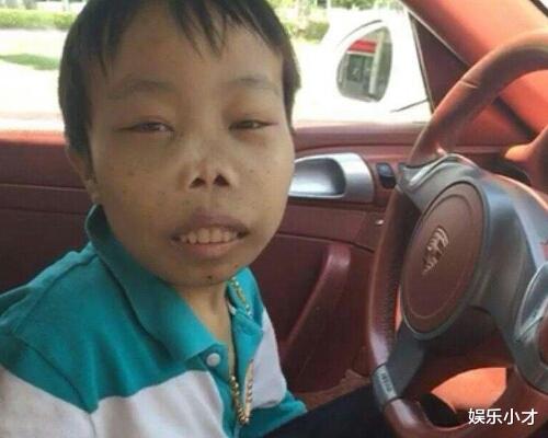 陈山|“龅牙怪”陈山的覆灭史:曾经的“卖丑”网红鼻祖,如今凄惨异常