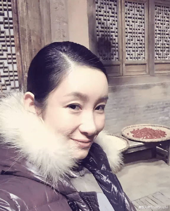 闫妮|女星割双眼皮如跨分水岭，没整好变“悲伤蛙”，成功则变气质美女