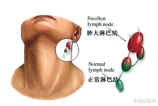 呼啦圈|“嗜酒如命”的人，若酒后出现4个现象应尽快戒酒，一运动补救