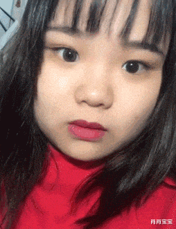 |老婆真不小心,膝盖在办公室都能磕成这样,我都心疼死了!啊哈哈哈