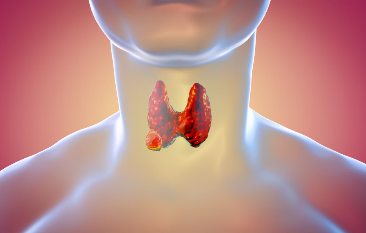 甲状腺结节|43岁大姐甲状腺结节转癌，提醒：3种食物或是癌变“加速剂”，别再贪吃