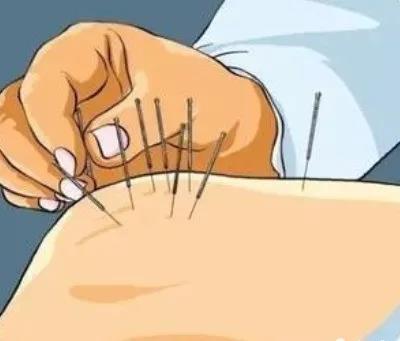 糖尿病|刘来发老师：膝关节积液的中医处理方法