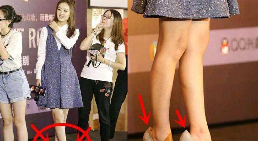 吴京|明星被掩盖的缺陷：吴京断指赵丽颖小脚，她没子宫无法生育被抛弃