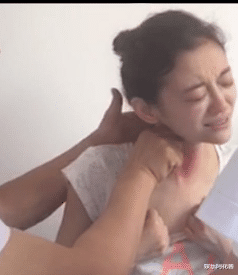 徐婷|被誉为“小赵雅芝”，被父母当作摇钱树，26岁全身溃烂离世