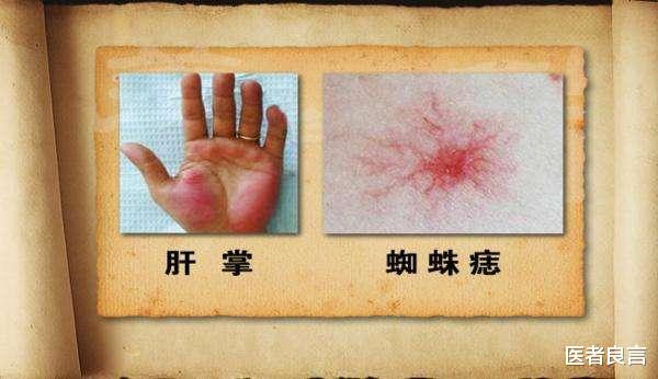 医者良言 养肝最好的方式是什么？