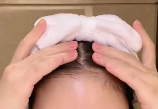 新潮育儿|杜淳老婆遭遇头发危机，每个妈妈都逃不掉产后脱发魔咒？