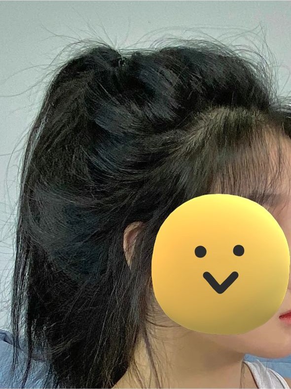 氨基酸 头发越洗越差？曝光洗发水“黑名单”：阿道夫脱毛膏，蜂花白月光