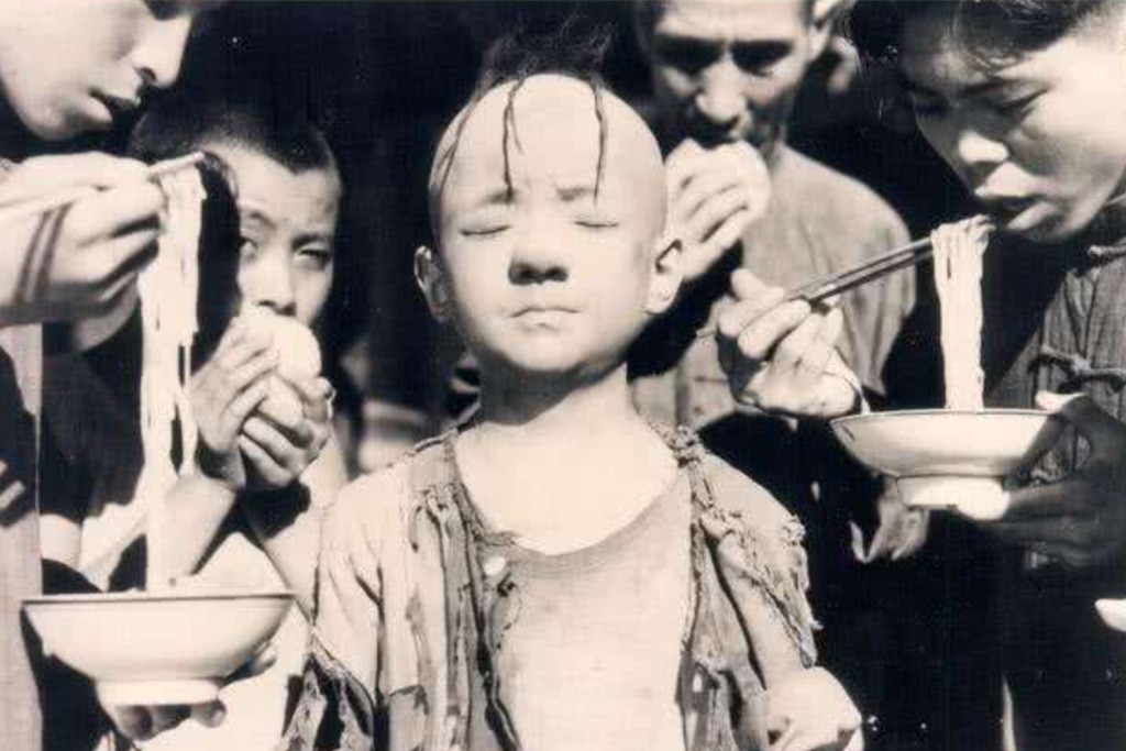 李嘉欣|“三毛”长大了!9岁爆火,16岁谢顶,植发挨300多针,34岁变帅哥