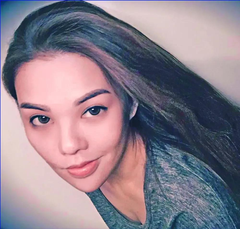 整容|演员高溜整容失败，鼻头坏死触目惊心，曾多次想自杀：整容需谨慎