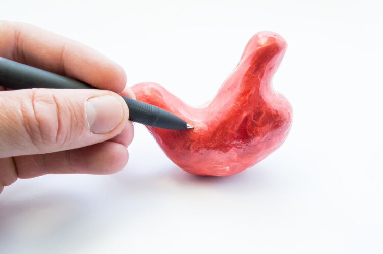 胃癌|患了胃癌，身体或有5个警报，别轻易忽视了！越早知道或还能救