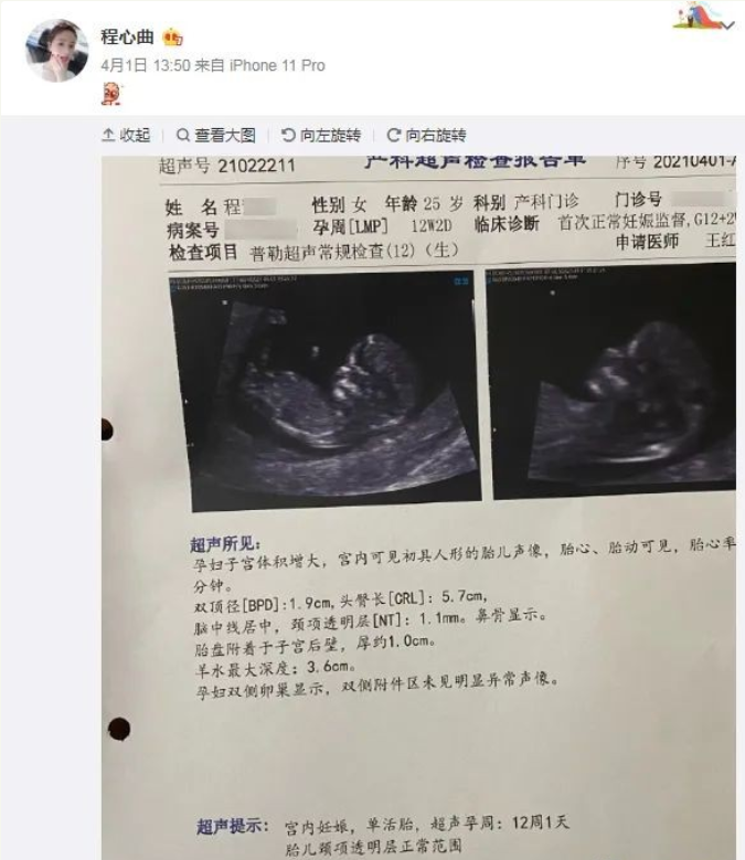 和豪刷700萬榜一奔現後，鬥魚女主播曬孕檢報告，已經懷孕12周-圖2