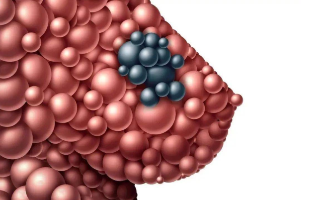 健康时报|天然“黄体酮”已找到，不是无花果，敞开喝，增生结节慢慢消散！