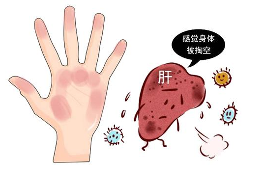 漫说健康|皮肤3种症状，别以为是小皮肤病，或许是肝脏病变发出的信号！