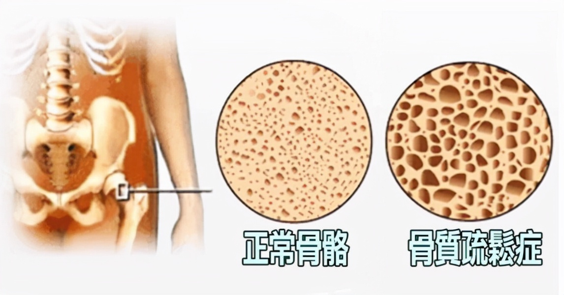 牛奶|吃一口胜喝5斤牛奶，医生：敞开吃，骨头紧密无间，脆骨变钢骨